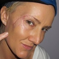 Keala Kennelly Çıplak