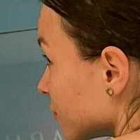 manja1 Çıplak