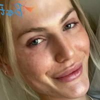 Tyler Loren Çıplak